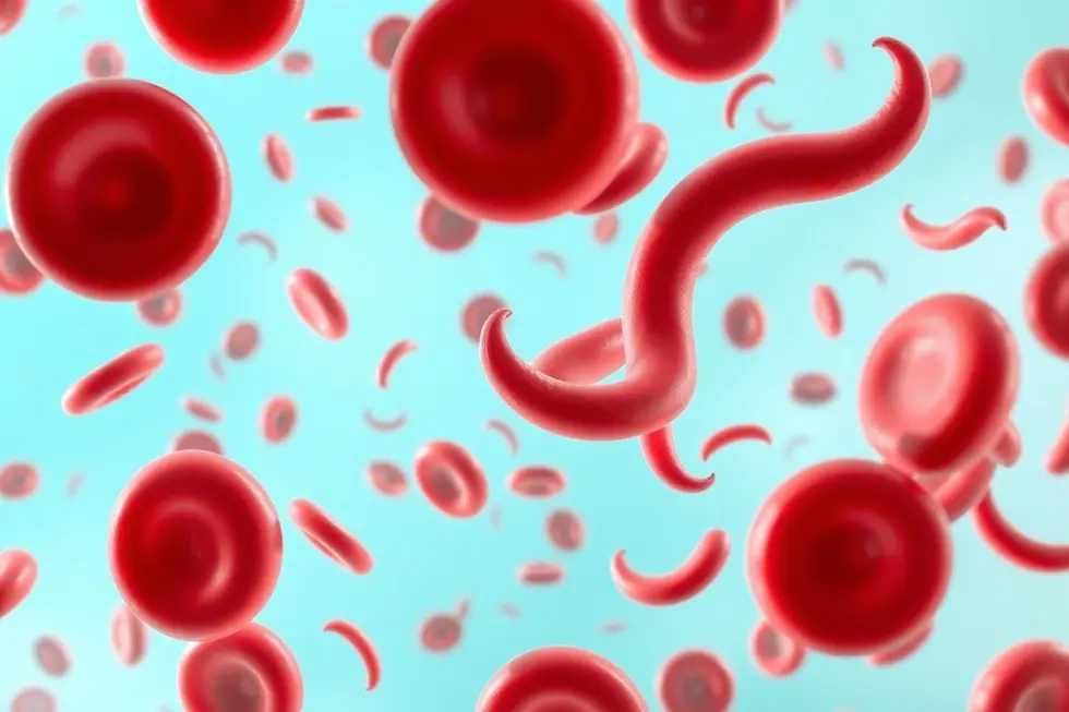 A visão geral da anemia falciforme