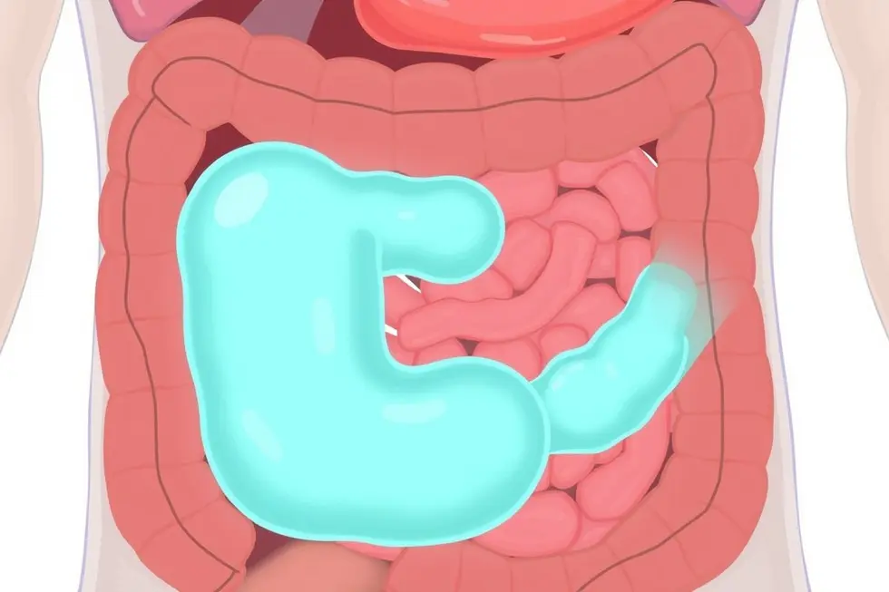 Compreendendo os Gases Intestinais: Causas e Sintomas